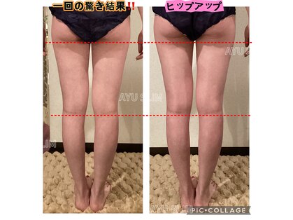 アユスリム(AYU SLIM)の写真