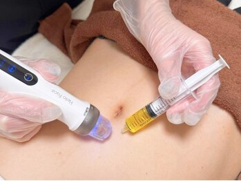 ナナイロ(nanairo)の写真/即実感!!脂肪分解【レモンボトル】で狙って脂肪撃退！最新脂肪冷却と相乗効果☆フェイスラインにも◎