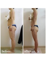 加圧ビューティーサロン スタイル エム(beauty salon style M)/40代/ピラティス×痩身リンパ