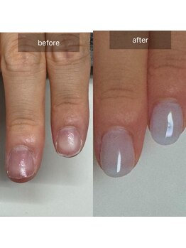 シープラス/深爪長さだし