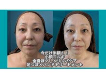 幸縁/小顔コルギ２回目