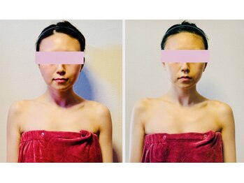 蓮(HASU)/小顔コルギ