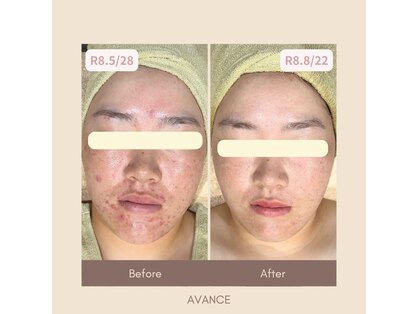 アヴァンス(AVANCE)の写真