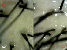 トトノエル(TOTONOEL)/真空ヘッドスパ