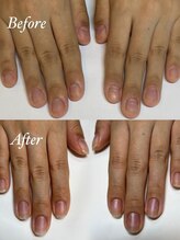 マリーロール 梅田店(Marie Laure)/自爪育成/深爪矯正/ネイルケア