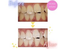 エクシア 伊勢店 サロンルナ/ビフォーアフター