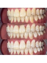 ライトビューティー 池袋店(LightBeauty)/症例写真