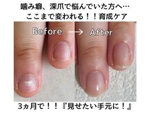 シーネイル(C Nail)