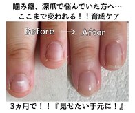 シーネイル(C Nail)