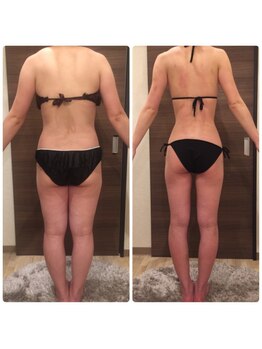 エステサロン ベリシモ(Bellissimo)/痩身/ビフォーアフター
