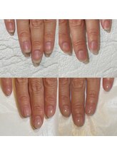 キュア(Cure.)/医師のお客様の自爪育成