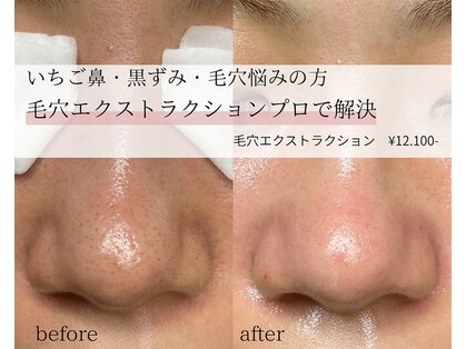 スイ(Suui.)の写真