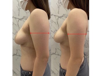 ユイットブランシュ(HUIT blanche)/溜まった疲れもハミ肉もすっきり