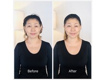 アリス(Alice)の雰囲気（フェイシャル小顔矯正でデコルテから、お顔の深層部へアプローチ）