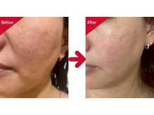 グリーン(green)/