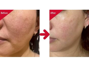 グリーン(green)/