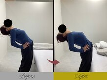 リン 大宮院(RIN)/骨膜整体での変化（担当：青野）