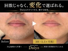 ダイヤ 名古屋中川区店(Daiya)の雰囲気（名古屋脱毛・中川区脱毛・メンズ脱毛なら高技術Daiyaにお任せ★）