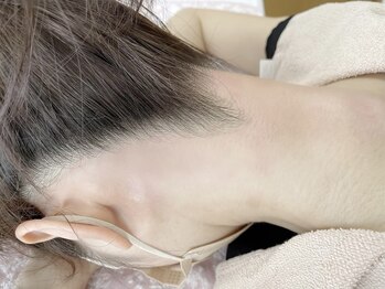 ルナベイビー 金山店(Luna Baby)/うなじワックス/うなじワックス