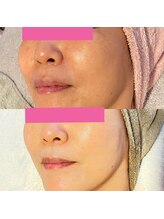 ピュアグレース 自由が丘/40代後半のお客様