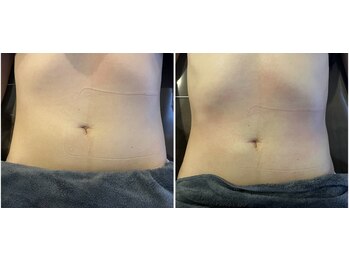 モア(moa)/くびれ