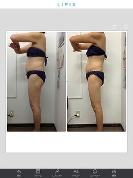 健康痩身研究所 蟹江店/ビフォーアフター