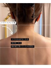 スパアルデバラン(spa.ALDEBARAN)/【深層リンパ(肩こり)】