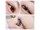 ムーナボーテ(Moona Beaute)の写真