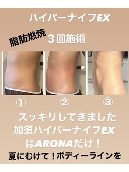アローナ(ARONA)/理想のボディーへ！