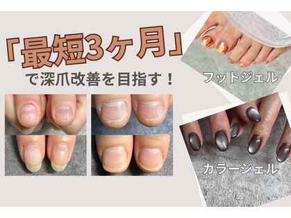レジューネイル(Rejyu Nail)の写真