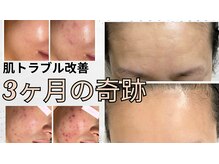 シャルナ(charna)