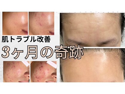 シャルナ(charna)の写真