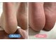 ルフレ(Reflet)の写真/年齢かかと卒業！つるつる美足へ☆保湿＆パラフィンパックでサンダル美人♪
