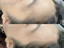 パルフェ(Parfait Eyelash Nail Salon)/【ワックス脱毛】