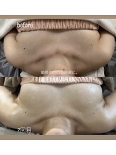 リュウ(le.lieu)/バストケア、1ヶ月の変化　No.2