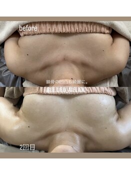 リュウ(le.lieu)/バストケア、1ヶ月の変化 No.2