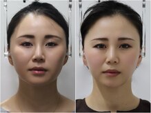さつま骨格矯正 表参道青山院/歪み小顔矯正＋骨盤矯正