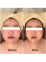 スペチアーレ 夙川/無敵の美顔作り