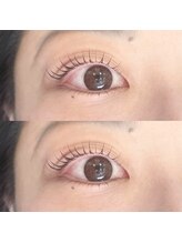 ネオン(Neon.)/リフトアップ！