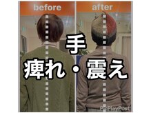 カワル整体 上通り院/手の震え・ピリピリ