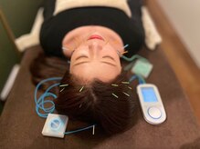 電気美容鍼でリフトアップ◎丁寧な施術で初めての方でも大歓迎!!