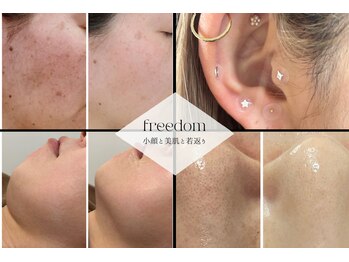 フリーダム(Freedom)