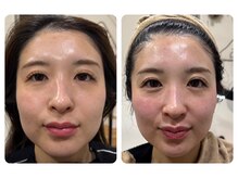 リモレア(RemoLe'a)の雰囲気（美肌の鍵は肌土台を整える【テラボーラー】たるみ改善/美肌）
