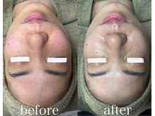 アディ(Adiy)/究極のエイジングケア