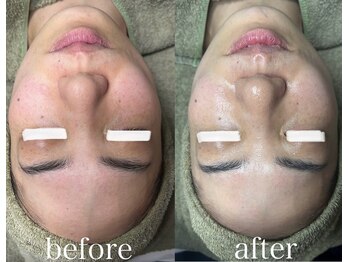 アディ(Adiy)/究極のエイジングケア