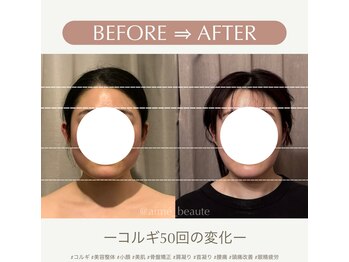 アイミーボーテ(Aime beaute)/コルギ