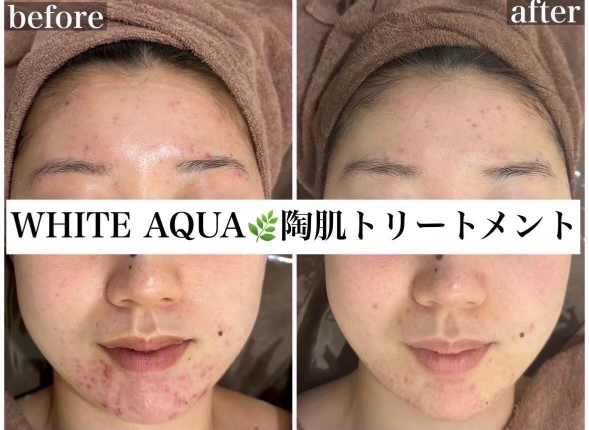 フォト｜ホワイトアクア 広島店(WHITE AQUA)｜ホットペッパービューティー