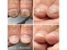 【ハンド】深爪・ダメージ爪の補修に　爪育成のためのスカルプチュア　１本