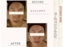 アロマ ソメイエ(Aroma Sommeiller)/バクテリウムピール★ハリ艶up！