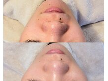 肌,毛穴はもちろん,荒れた唇・メイク残り・睫毛ケアもできます◎